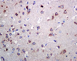 Ndufs4 Antibody Ep7832 Bsa And Azide Free Ab232337  Immunohistochemistry Formalin Pfa Fixed Paraffin Embedded Sections Img137078