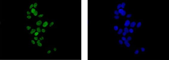 Sox9 Antibody Epr12755 50 Bsa And Azide Free Ab250751  Immunocytochemistry Immunofluorescence Img107014