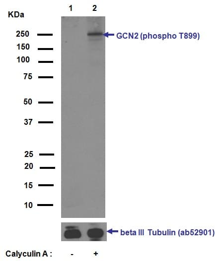 Anti-GCN2 (phospho T899) antibody [EPR2320Y](ab75836)