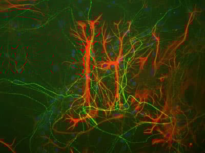 Anti-GFAP antibody [2A5](AB4648)