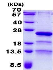 Recombinant Human RP9 protein(AB139200)