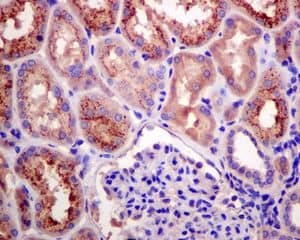 Rbp4 Antibody Epr5879 Bsa And Azide Free Ab248553  Immunohistochemistry Formalin Pfa Fixed Paraffin Embedded Sections Img19883