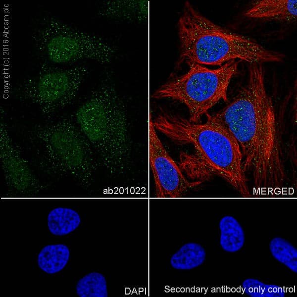 Anti-ATM antibody [EPR20100] - ChIP Grade(AB201022)