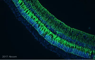 Anti-Vimentin antibody [EPR3776] - Cytoskeleton Marker(AB92547)