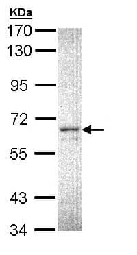 Cerk Antibody Ab155061  Western Blot Img96846