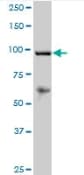 Reck Antibody Ab88249  Western Blot Img149084