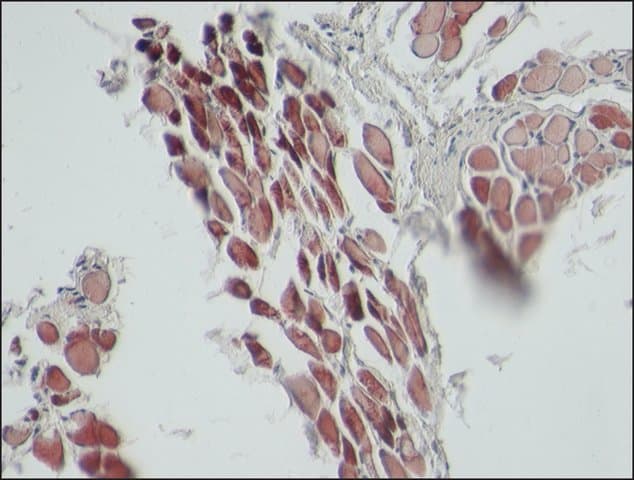 Anti-Sarcomeric Alpha Actinin antibody [EA-53](AB9465)