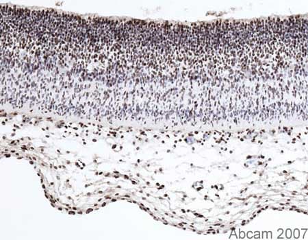 Anti-PCNA antibody [PC10](AB29)
