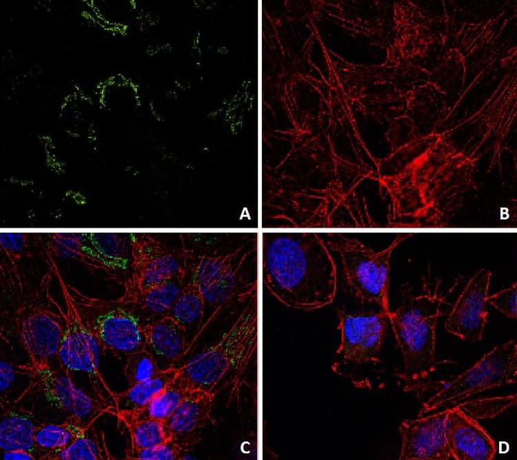 Anti-Lysozyme antibody [LZ598-10G9](AB234194)
