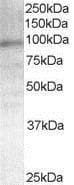 Anti-Androgen Receptor antibody(AB19066)