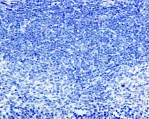 Snap25 Antibody Ep3274 Ab108990  Immunohistochemistry Formalin Pfa Fixed Paraffin Embedded Sections Img98534