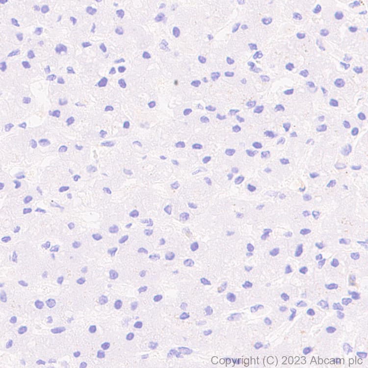 Anti-Sez6 antibody [EPR28518-55](AB314233)