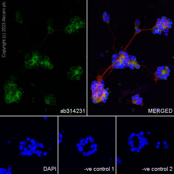 Anti-RS1 antibody [EPR28513-78](AB314231)