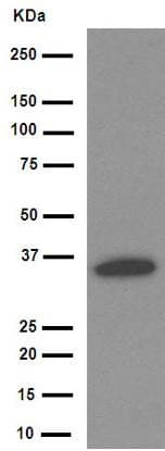 Anti-IKB alpha antibody [E130](AB32518)