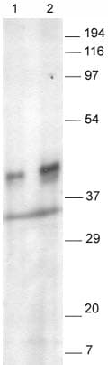 Anti-Synaptophysin antibody(AB14692)