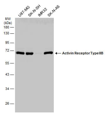 Anti-Activin Receptor Type IIB/ACVR2B antibody(AB272869)
