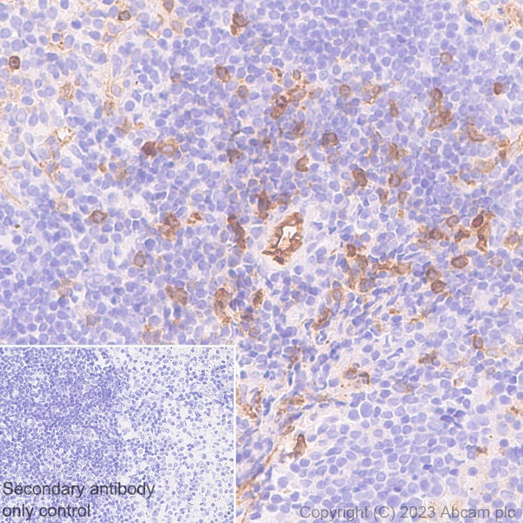 Anti-Ly6c antibody [EPR27220-23](AB314120)