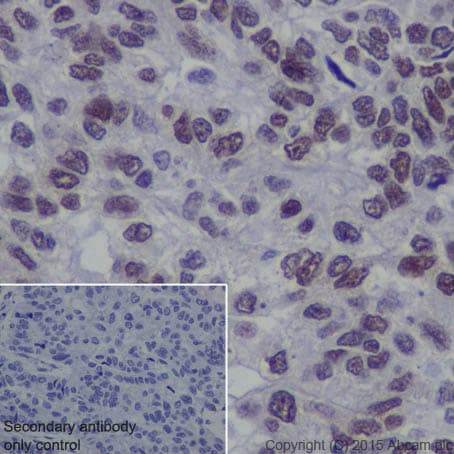 Anti-EHMT2/G9A antibody [EPR18894] - ChIP Grade - BSA and Azide free(AB240289)