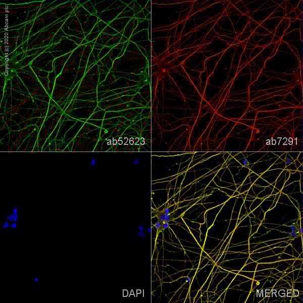 Anti-beta III Tubulin antibody [EP1569Y] - Neuronal Marker(AB52623)