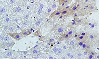 Light Tnfsf14 Antibody Ab203578  Immunohistochemistry Formalin Pfa Fixed Paraffin Embedded Sections Img98053