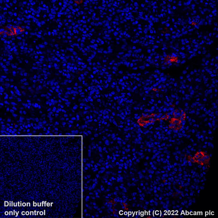 Alexa Fluor® 647 Anti-Sialoadhesin/CD169 antibody [SP216](AB306568)
