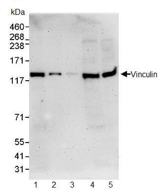 Anti-Vinculin antibody(AB91459)