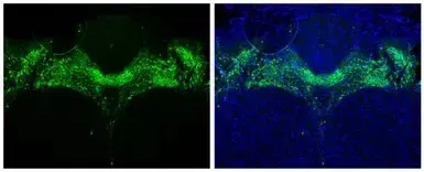 Anti-Tyrosine Hydroxylase antibody(AB137721)