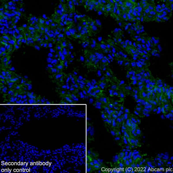 Anti-Aquaporin 5 antibody [EPR27474-70] - BSA and Azide free(AB305304)