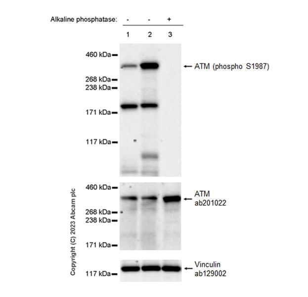 Anti-ATM antibody [EPR20100] - ChIP Grade(AB201022)