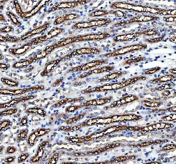 Slc12a1 Nkcc2 Antibody N Terminal Ab191315  Immunohistochemistry Formalin Pfa Fixed Paraffin Embedded Sections Img450987