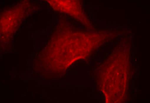 Nf Kb P65 Phospho S311 Antibody Ab194926  Immunocytochemistry Immunofluorescence Img113809