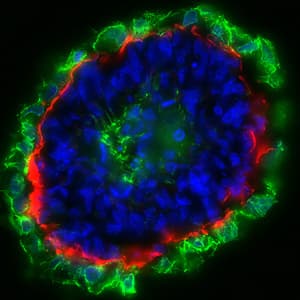 Anti-Cytokeratin 8 antibody [EP1628Y] - Cytoskeleton Marker(AB53280)