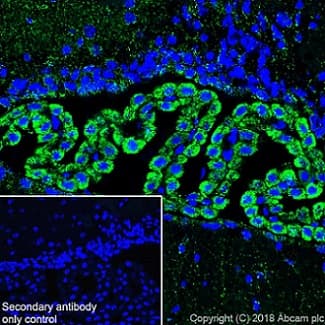 Abat Gaba T Antibody Epr20842 Bsa And Azide Free Ab233702  Immunohistochemistry Frozen Sections Img14204