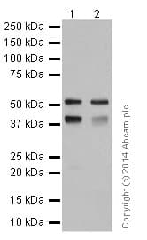 Anti-Cytokeratin 7 antibody [EPR17078] - Cytoskeleton Marker(AB181598)