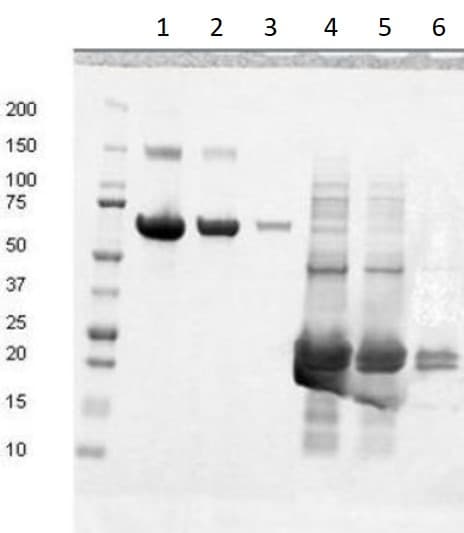 Recombinant Human Fibronectin type III EDB protein(AB209886)