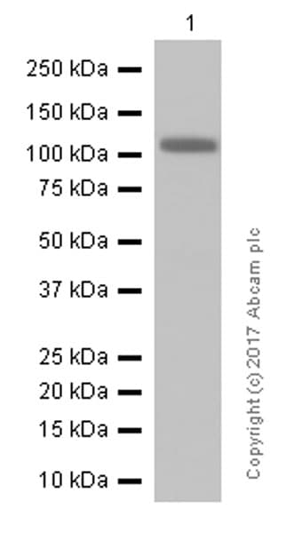 Anti-Androgen Receptor antibody [ER179(2)] - ChIP Grade(AB108341)