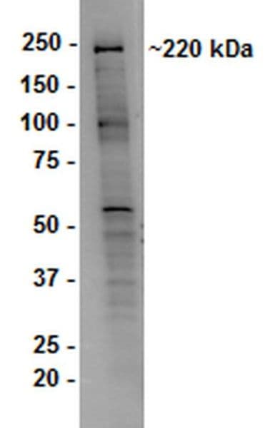 Anti-Dicer antibody [13D6] - ChIP Grade(AB14601)