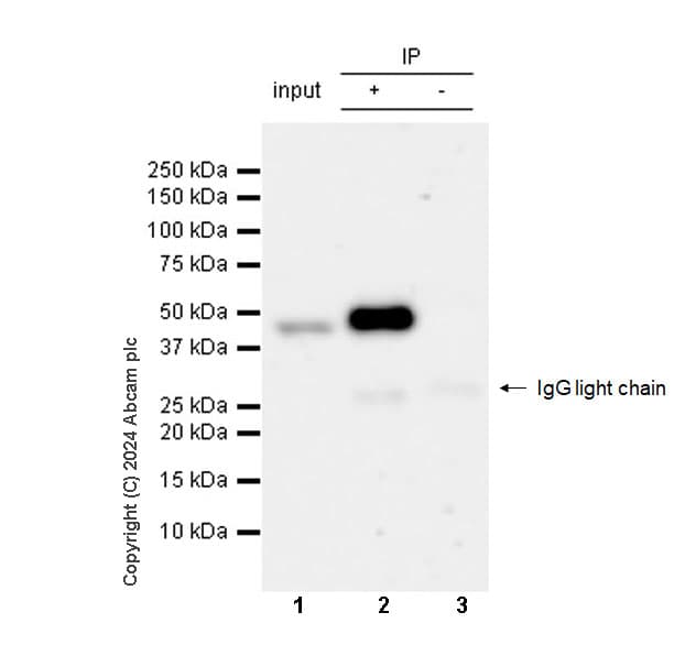 Mouse IgG1, kappa monoclonal [MOPC-21] - isotype control(AB18443)