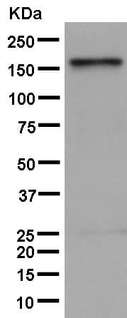 Anti-KDM5B / PLU1 / Jarid1B antibody [EPR12704](AB181089)