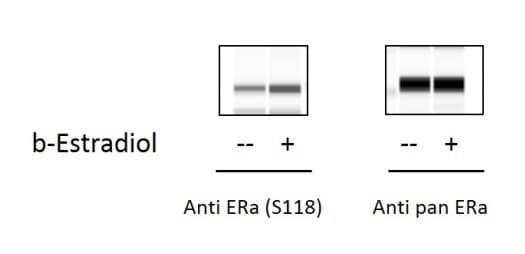 Phospho Estrogen Receptor Alpha Ser118 Elisa Kit Ab279786  Sandwich Elisa Img6399