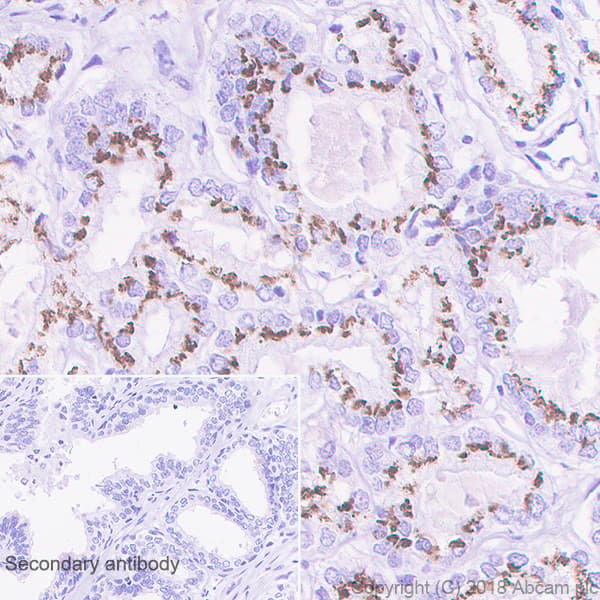 Slc45a3 Antibody Epr47952 Bsa And Azide Free Ab242056  Immunohistochemistry Formalin Pfa Fixed Paraffin Embedded Sections Img129308