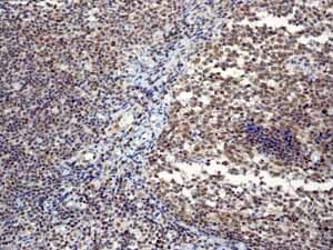 Sumo 1 Antibody Ep298 Bsa And Azide Free Ab248491  Immunohistochemistry Formalin Pfa Fixed Paraffin Embedded Sections Img129446