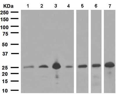 Snap25 Antibody Ep3274 Ab108990  Western Blot Img104568