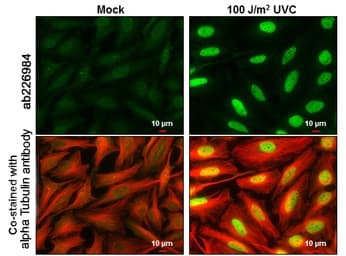 Anti-Chk2 (phospho T68) antibody(AB226984)