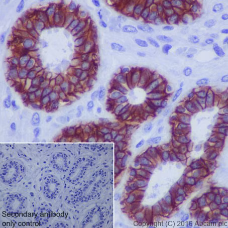 Trop2 Antibody Epr20043 Ab214488 Immunohistochemistry Formalin Pfa Fixed Paraffin Embedded Sections Img41503
