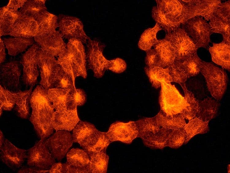 Cytokeratin 17 Antibody Ep1623 Bsa And Azide Free Ab239986  Immunocytochemistry Immunofluorescence Img3644