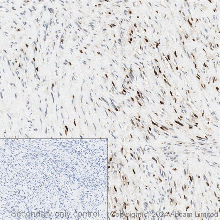 Anti-Myogenin antibody [EPR4789](AB124800)