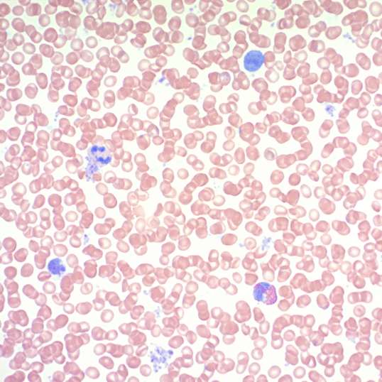 Giemsa Stain Kit Ab150670  Histology Img444500
