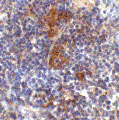 Anti-SQSTM1 / p62 antibody(AB91526)