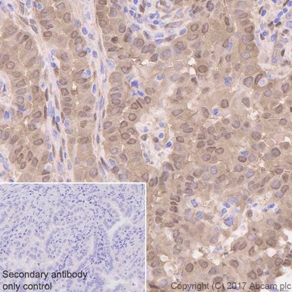 Anti-YAP1 antibody [EP1674Y](AB52771)